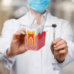 Endodontia (Tratamento de Canal)