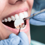 Cirurgias (Extrações)